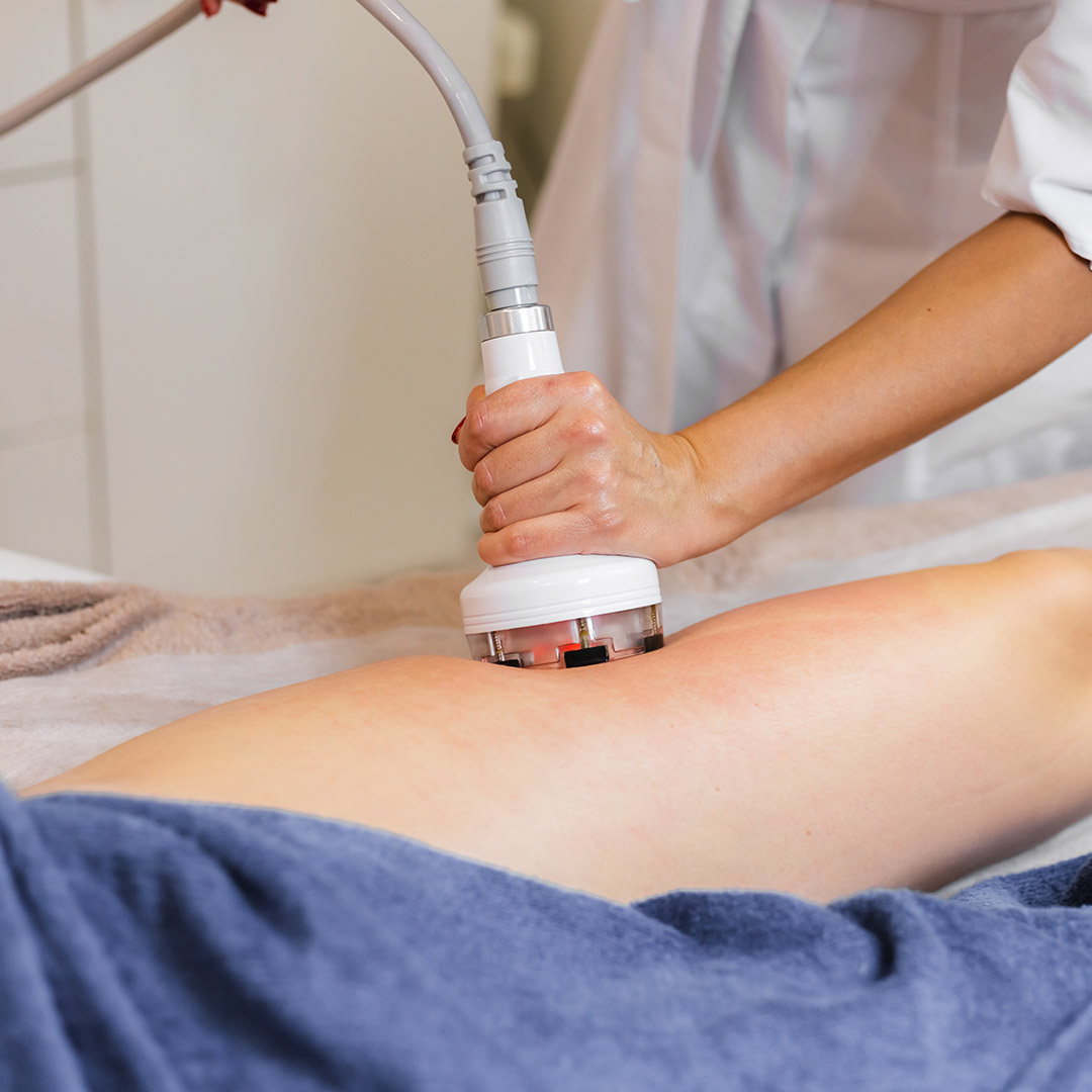 melbourne-cosmetic-laser-clinic-body-contouring-procedure