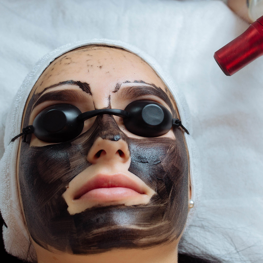 melbourne-cosmetic-laser-clinic-carbon-peel-procedure
