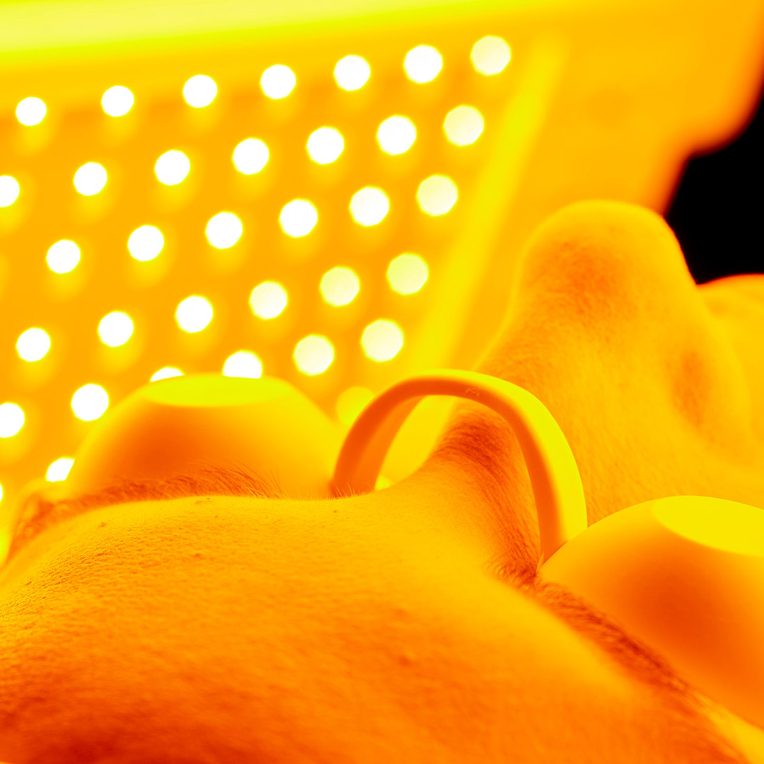 melbourne-cosmetic-laser-clinic-healite-led-procedure-2