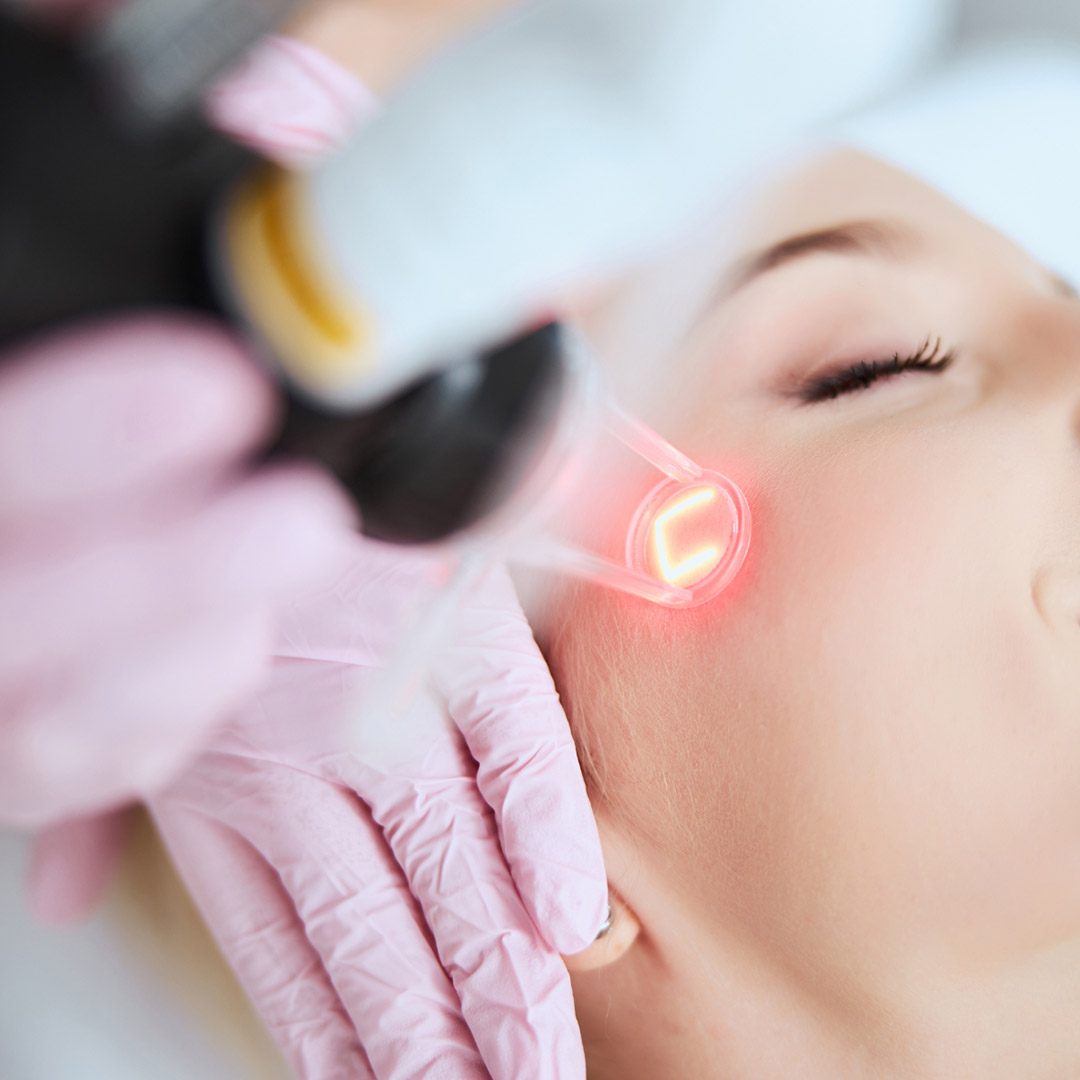 melbourne-cosmetic-laser-clinic-laser-resurfacing