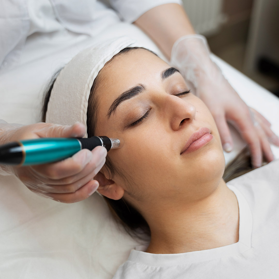 melbourne-cosmetic-laser-clinic-microneedling-procedure-2